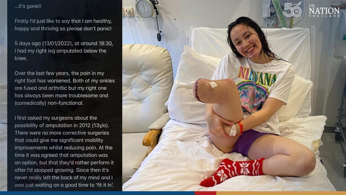Alice Tai has leg amputated below knee